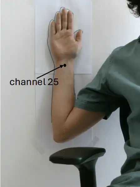 Oscar Arm Channel 25